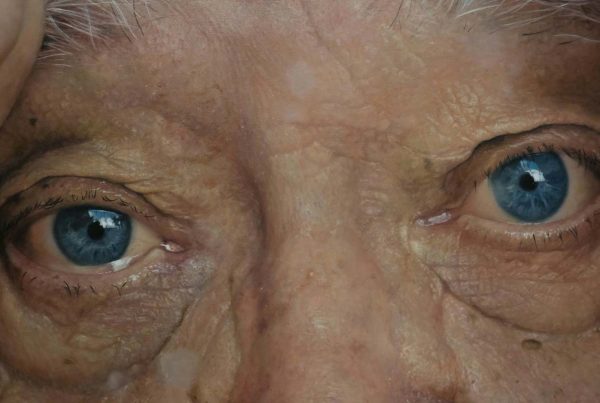 La malattia di Alzheimer - immagine anteprima post