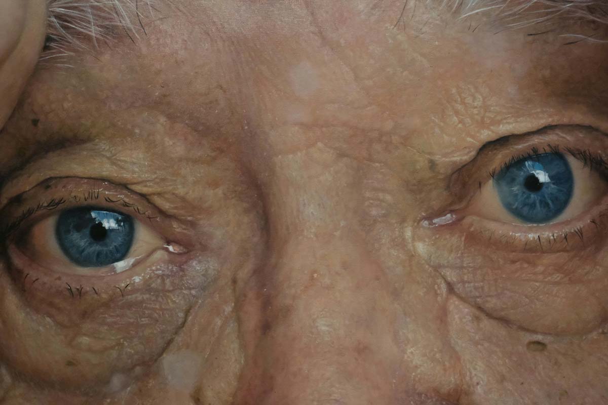 La malattia di Alzheimer - immagine anteprima post